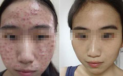 合肥肤康皮肤病医院