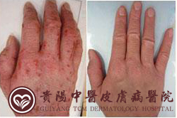 合肥肤康皮肤病医院皮肤科