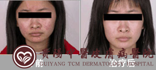 �Ϸʷ���Ƥ����ҽԺ